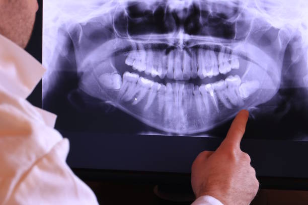 Best Chipped Tooth Repair Near Me  in Coalinga, CA